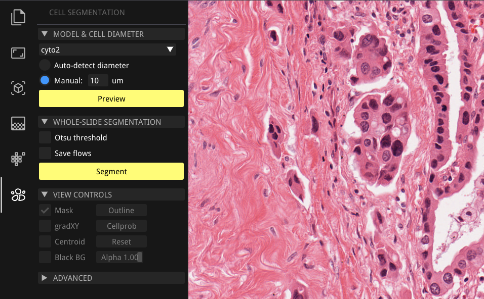 ../_images/cellseg_workbench_panel.png