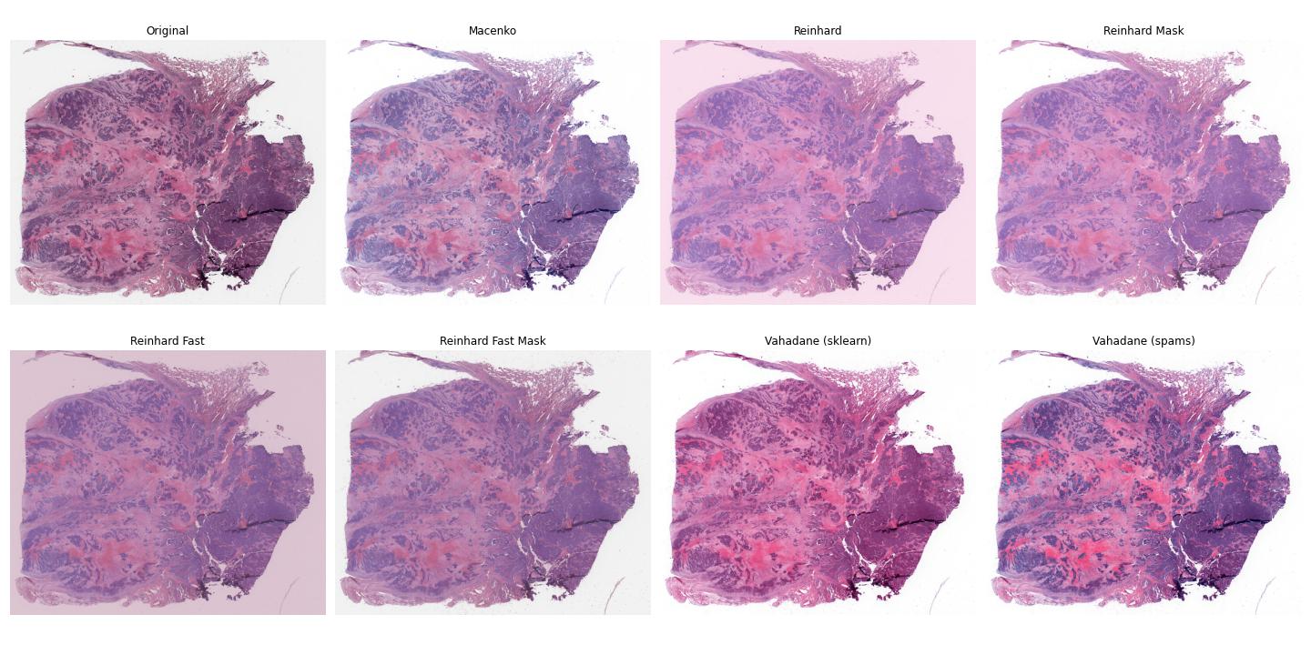 ../_images/wsi_norm_compare.jpg